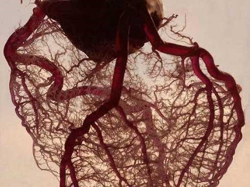 Chàng trai 29 tuổi có huyết quản như bã đậu, suýt đột quỵ vì thói quen xấu