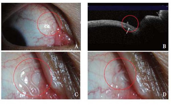 Bé trai 2 tuổi suýt bị mù vĩnh viễn chỉ vì bố mẹ lười-2