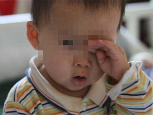 Bé trai 2 tuổi suýt bị mù vĩnh viễn chỉ vì bố mẹ lười-3