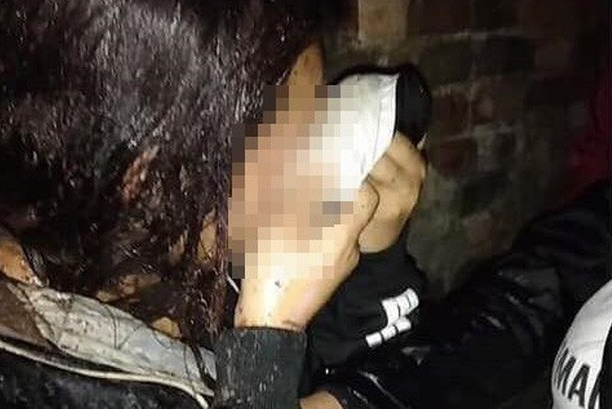 Đánh ghen kinh hoàng bằng mắm tôm trộn nước mắm ở Bắc Ninh: Nhiều lần cảnh cáo?-1