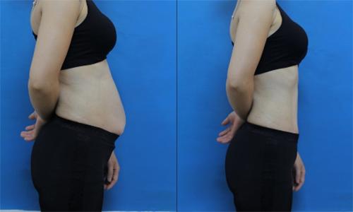 Mỡ bụng vài ngấn cũng bị đánh bay với nồi nước gừng thần thánh này-6