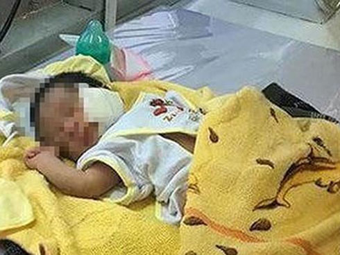 Hình ảnh mới nhất của bé Bích bị bỏ rơi, người đầy vẩy ngứa như da trăn sau đợt khám bệnh đầu tiên tại Singapore-13