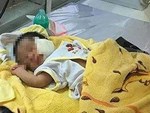 Hình ảnh mới nhất của bé Bích bị bỏ rơi, người đầy vẩy ngứa như da trăn sau đợt khám bệnh đầu tiên tại Singapore-13