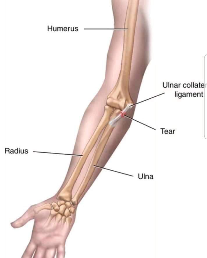 Messi gãy tay rùng rợn sau pha tiếp đất lỗi, băng bó ngay trên sân và chắc chắn vắng mặt ở trận Siêu kinh điển-8