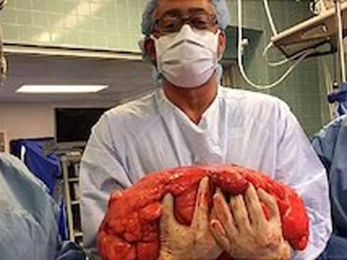 Chưa từng gặp ở Việt Nam: Người đàn ông mắc ung thư 48 năm nay vẫn sống khỏe mạnh-3