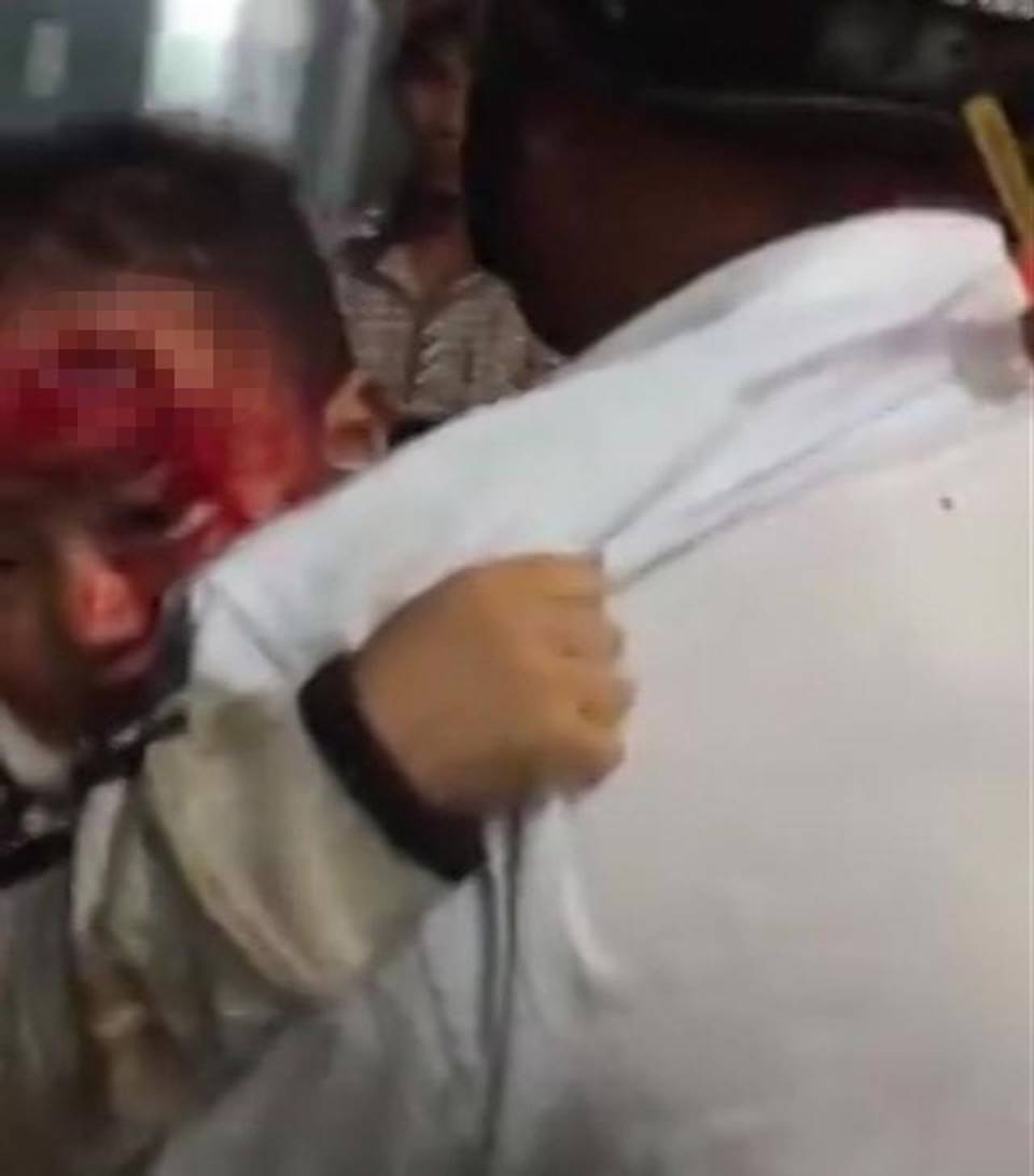 Bệnh viện vắng tanh, cha ôm con máu chảy đầm đìa chờ bác sĩ-1