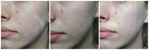 Phụ nữ mà không biết đến những nguyên tắc này, bạn đừng mơ có làn da đẹp-1