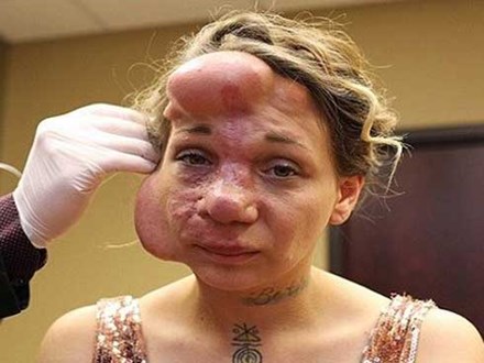 Người phụ nữ có gương mặt chực vỡ tung vì nguyên nhân lạ