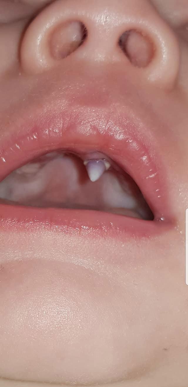 Sáng sớm thức dậy mà con trai không ngừng khóc, bà mẹ phát hoảng khi nhìn thấy vật kinh dị này trong miệng con-1