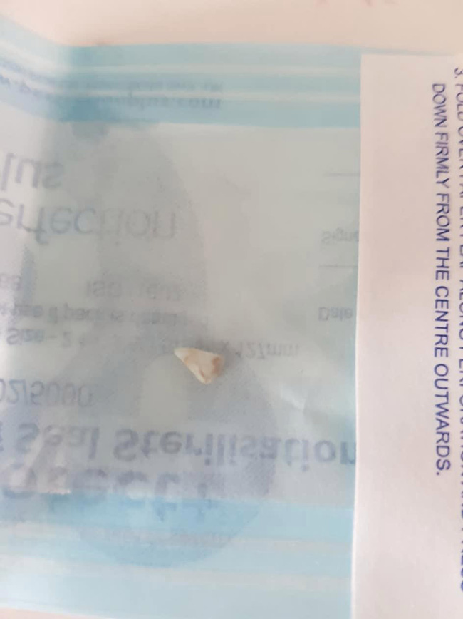 Sáng sớm thức dậy mà con trai không ngừng khóc, bà mẹ phát hoảng khi nhìn thấy vật kinh dị này trong miệng con-4