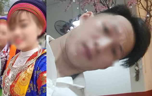 Yêu nhau 6 tháng, chàng trai cay đắng phát hiện mình quá thừa canxi, một lúc trồi lên chục cặp sừng-2