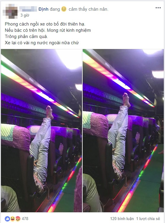 Đôi chân tai ngược khiến đám đông lập tức muốn che mắt, bịt mũi-1