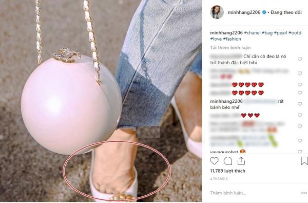 Ngoài chiếc cằm gây hốt hoảng, fan còn chú ý khuyết điểm này của Minh Hằng-2