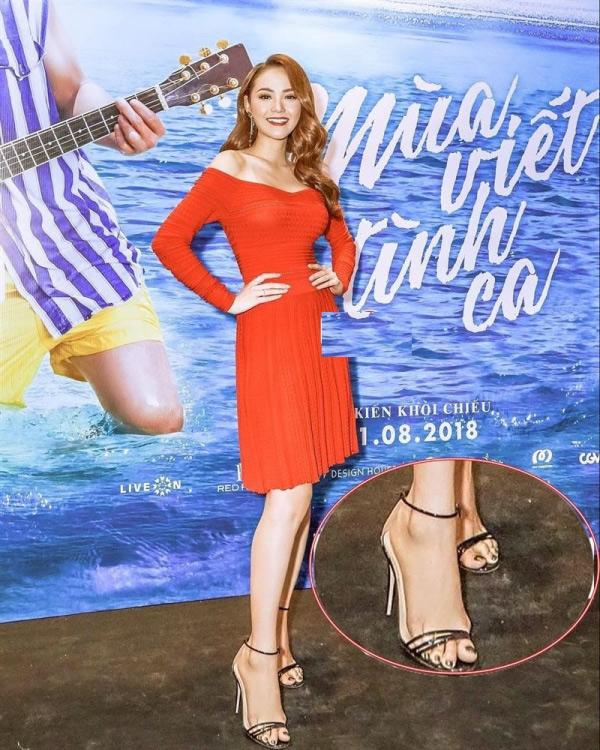 Ngoài chiếc cằm gây hốt hoảng, fan còn chú ý khuyết điểm này của Minh Hằng-4