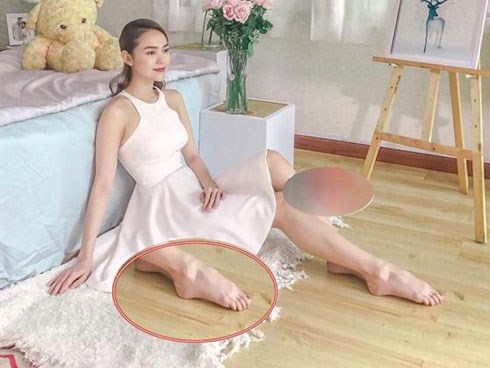 Ngoài chiếc cằm gây hốt hoảng, fan còn chú ý khuyết điểm này của Minh Hằng