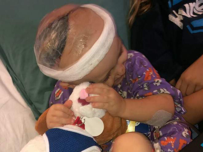 Hình ảnh khủng khiếp của cậu bé 2 tuổi sau tai nạn ô tô khiến phụ huynh không khỏi giật mình-1