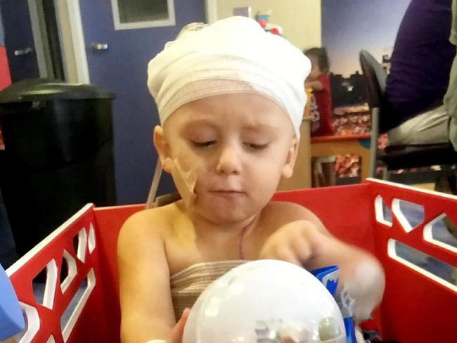 Hình ảnh khủng khiếp của cậu bé 2 tuổi sau tai nạn ô tô khiến phụ huynh không khỏi giật mình-2