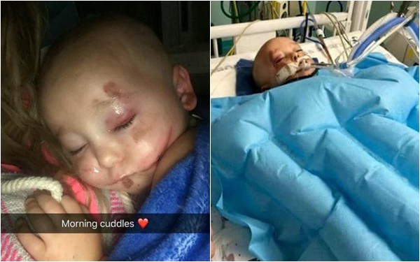Hình ảnh khủng khiếp của cậu bé 2 tuổi sau tai nạn ô tô khiến phụ huynh không khỏi giật mình-3