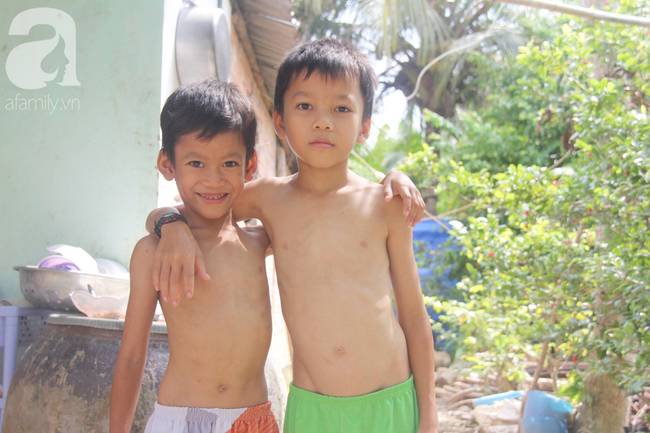 4 đứa trẻ mồ côi cha, ốm trơ xương vì đói ăn bên bà nội già yếu sau khi mẹ bỏ đi lấy chồng mới-10