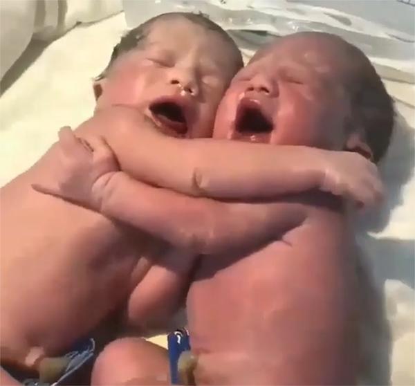 Đang khóc váng trời khi vừa chào đời, cặp song sinh vẫn làm một hành động kỳ diệu-1