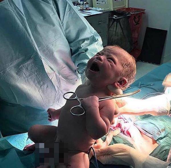 Đang khóc váng trời khi vừa chào đời, cặp song sinh vẫn làm một hành động kỳ diệu-2