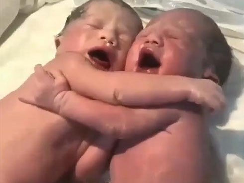 Đang khóc váng trời khi vừa chào đời, cặp song sinh vẫn làm một hành động kỳ diệu