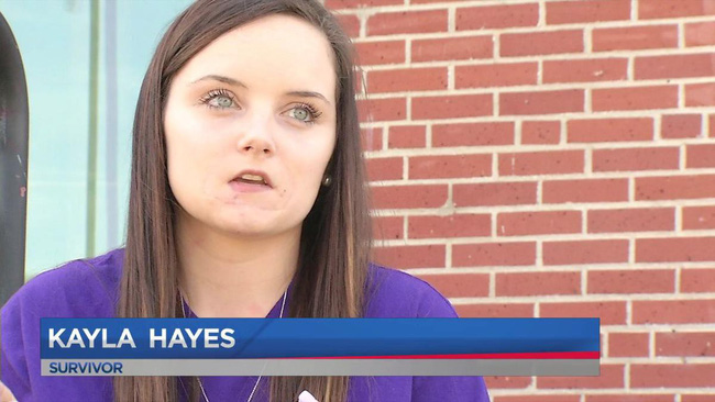 Chia sẻ nghẹn ngào của cô gái mặt biến dạng, 1 năm sau khi bị bạn trai cũ cắn đứt lìa môi vì từ chối nối lại tình xưa-4