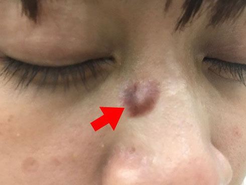 Vì sao tế bào ung thư sinh sôi và di căn nhanh bất thường?-2