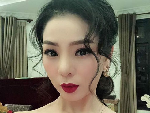Được fan khen trẻ như 18 sau tháo độn mũi, Lệ Quyên thở phào: 