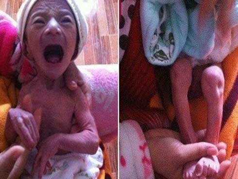 Sinh con đầu lòng giống “ông già”, bác sĩ chẩn đoán bệnh khiến cả nhà bật khóc