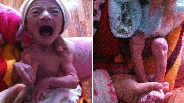 Sinh con đầu lòng giống ông già”, bác sĩ chẩn đoán bệnh khiến cả nhà bật khóc-2