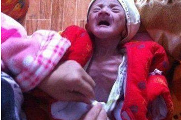 Sinh con đầu lòng giống ông già”, bác sĩ chẩn đoán bệnh khiến cả nhà bật khóc-1