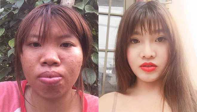 Phượng Thị Nở” bất ngờ bị ngã trầy xước mặt mũi sau gần 2 năm thẩm mỹ khiến nhiều người lo lắng-1