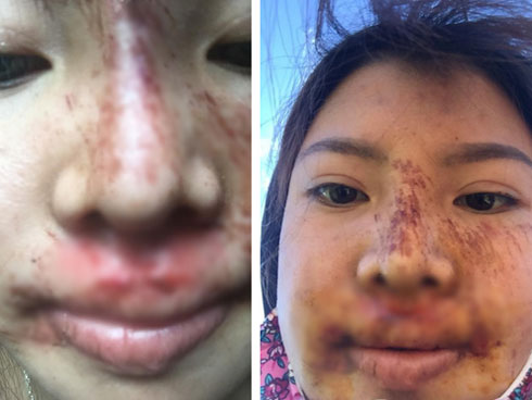 Bị chê xuống sắc hậu dao kéo, Phượng Thị Nở khoe ảnh nhan sắc thay đổi chóng mặt-8