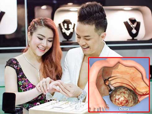 Chuyên gia khẳng định: Những ai tin rằng ăn kiểu này chữa được bệnh ung thư sẽ phải hối hận!-6