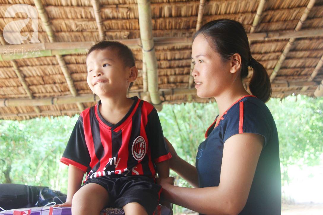 Phép màu đến với bé trai 4 tuổi mù một mắt, luôn hỏi mẹ ngây ngô: Con không thấy đường, mẹ có bỏ con không?-4
