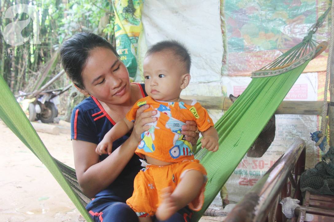 Phép màu đến với bé trai 4 tuổi mù một mắt, luôn hỏi mẹ ngây ngô: Con không thấy đường, mẹ có bỏ con không?-7