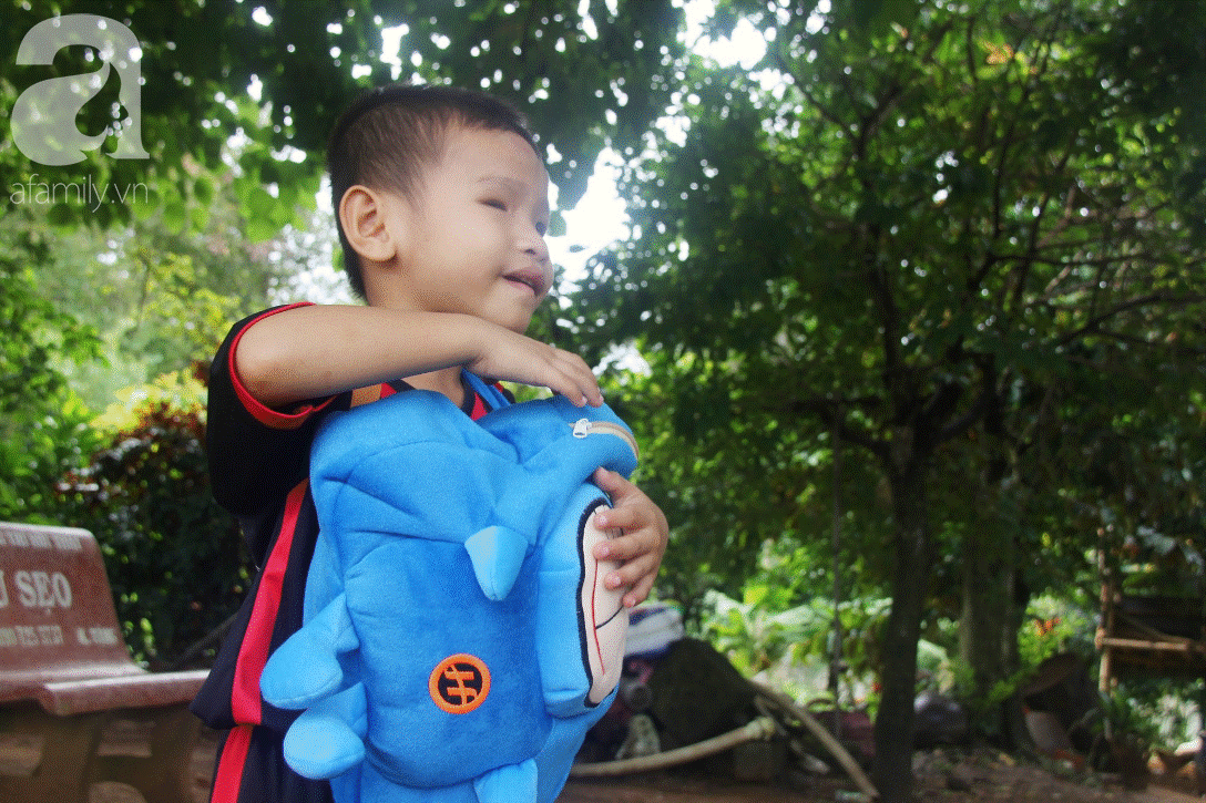 Phép màu đến với bé trai 4 tuổi mù một mắt, luôn hỏi mẹ ngây ngô: Con không thấy đường, mẹ có bỏ con không?-8