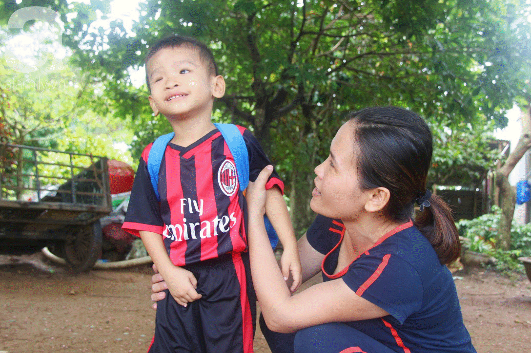 Phép màu đến với bé trai 4 tuổi mù một mắt, luôn hỏi mẹ ngây ngô: Con không thấy đường, mẹ có bỏ con không?-10