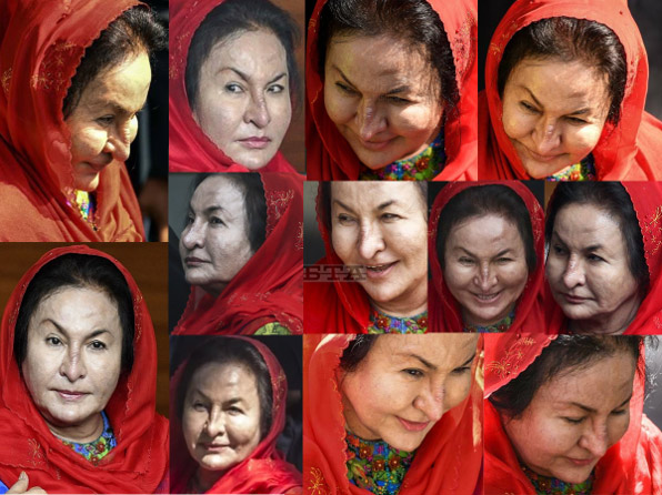 Gương mặt phu nhân cựu Thủ tướng Malaysia biến dạng  vì thẩm mỹ-3