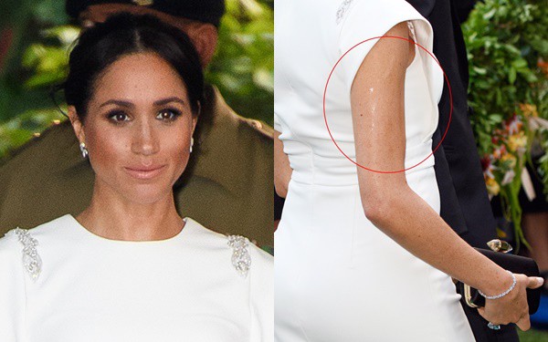 Meghan bị soi cánh tay bóng nhẫy như bôi mỡ, thực chất đây là lý do khiến ai cũng bất ngờ-1