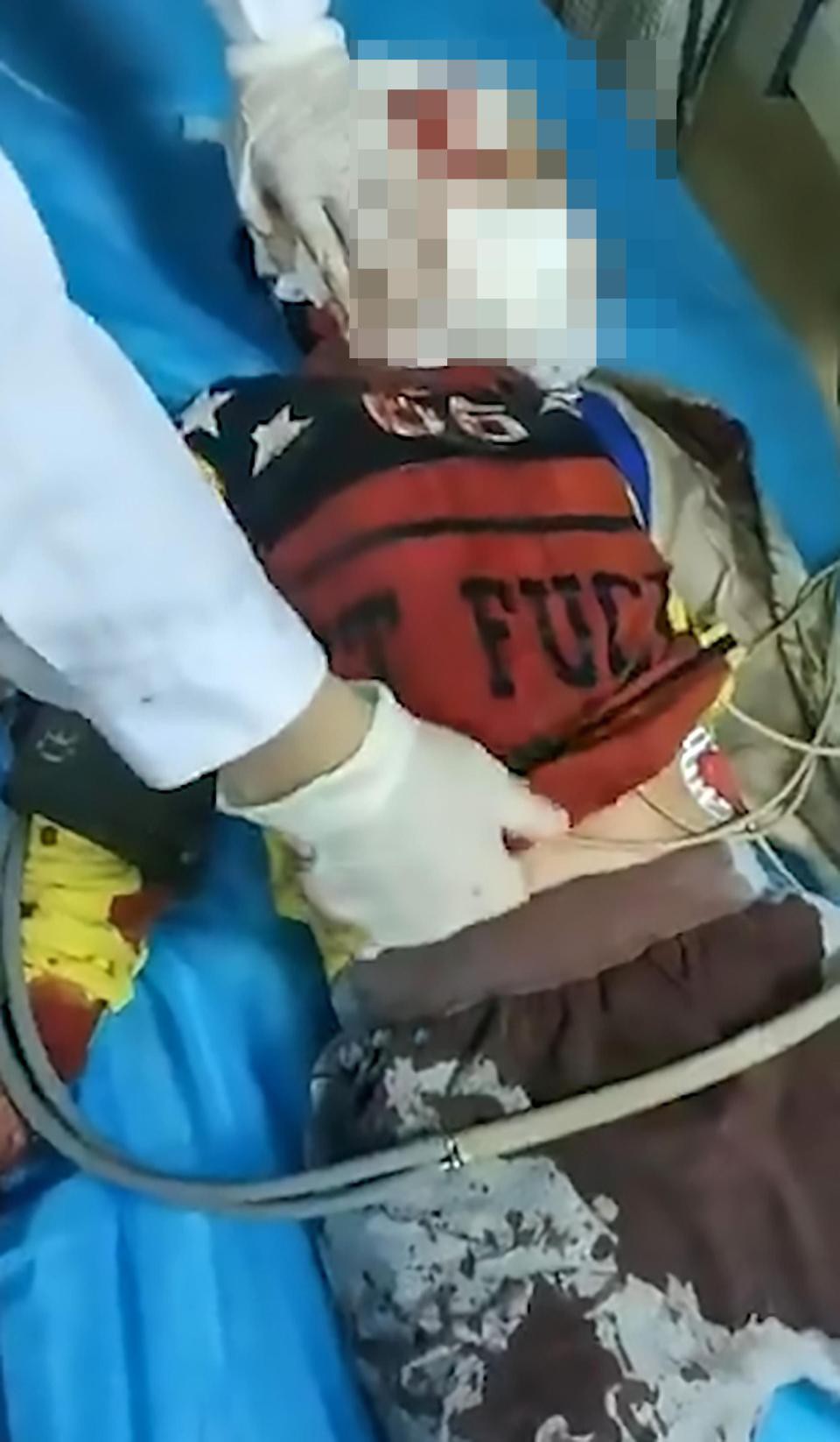 Trung Quốc: Người phụ nữ loạn trí cầm dao chặt thịt tấn công trường mẫu giáo, ít nhất 14 học sinh bị thương-3