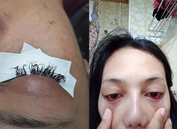 Ham rẻ và nhận kết đắng, chuyện biết rồi, khổ lắm, nói mãi, nhưng chị em vẫn cứ không chừa!-5