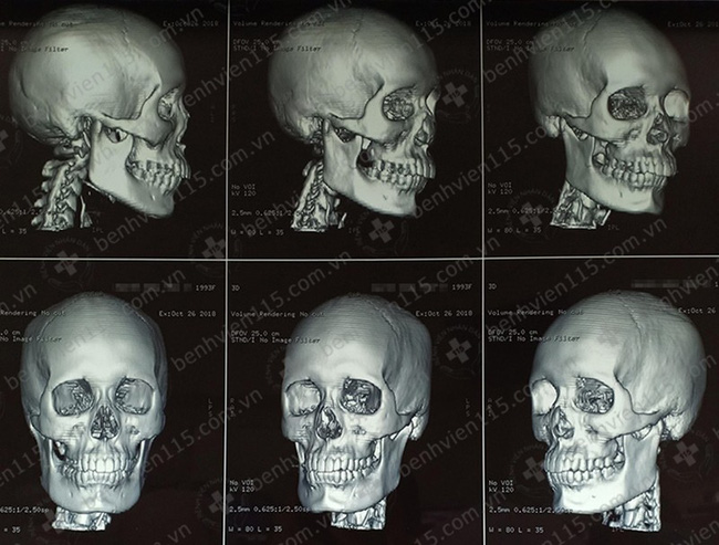 TP.HCM: Bị giật túi xách ngã xuống đường, một cô gái tử vong thương tâm-2