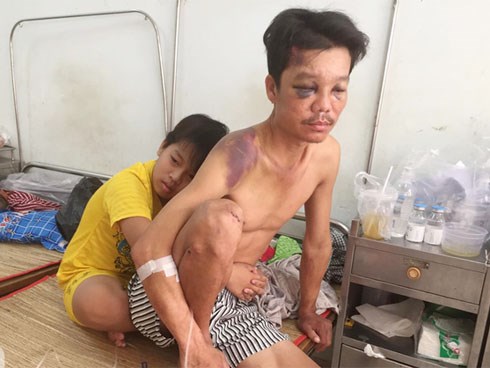 Mẹ bỏ đi lấy chồng, điều ước của bé trai 12 tuổi sống với người cha khờ bệnh tật khiến ai cũng xúc động