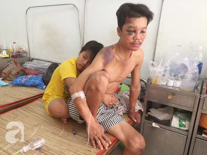 Mẹ bỏ đi lấy chồng, điều ước của bé trai 12 tuổi sống với người cha khờ bệnh tật khiến ai cũng xúc động-5