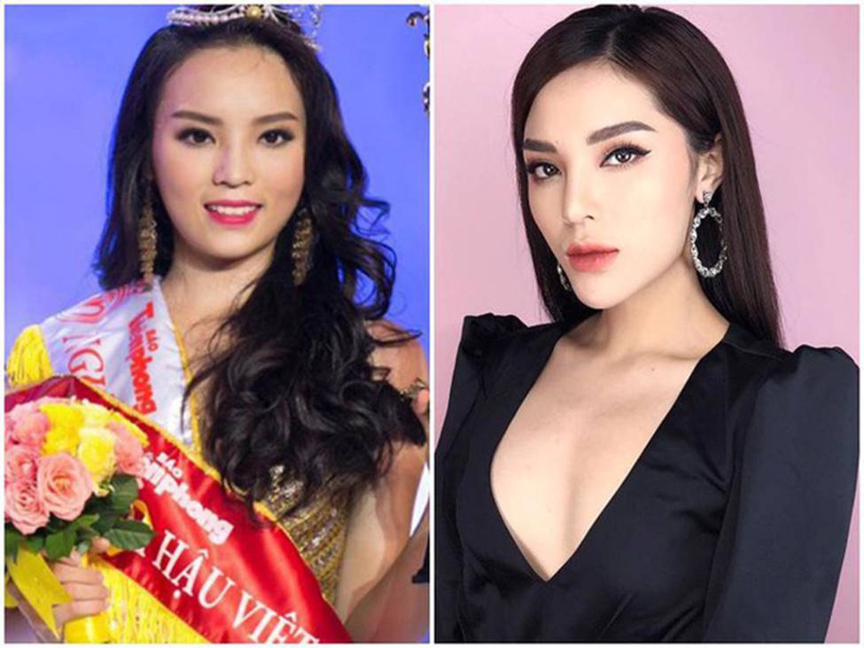 Ảnh: Trước Lệ Quyên, nhiều sao Việt gặp sự cố nhan sắc vì dao kéo-5