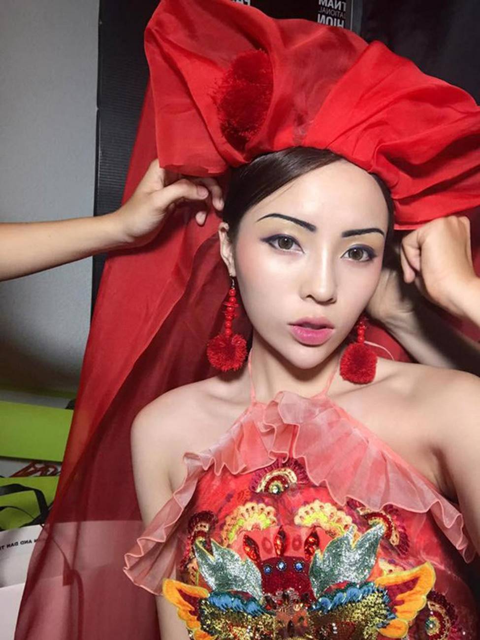 Ảnh: Trước Lệ Quyên, nhiều sao Việt gặp sự cố nhan sắc vì dao kéo-6