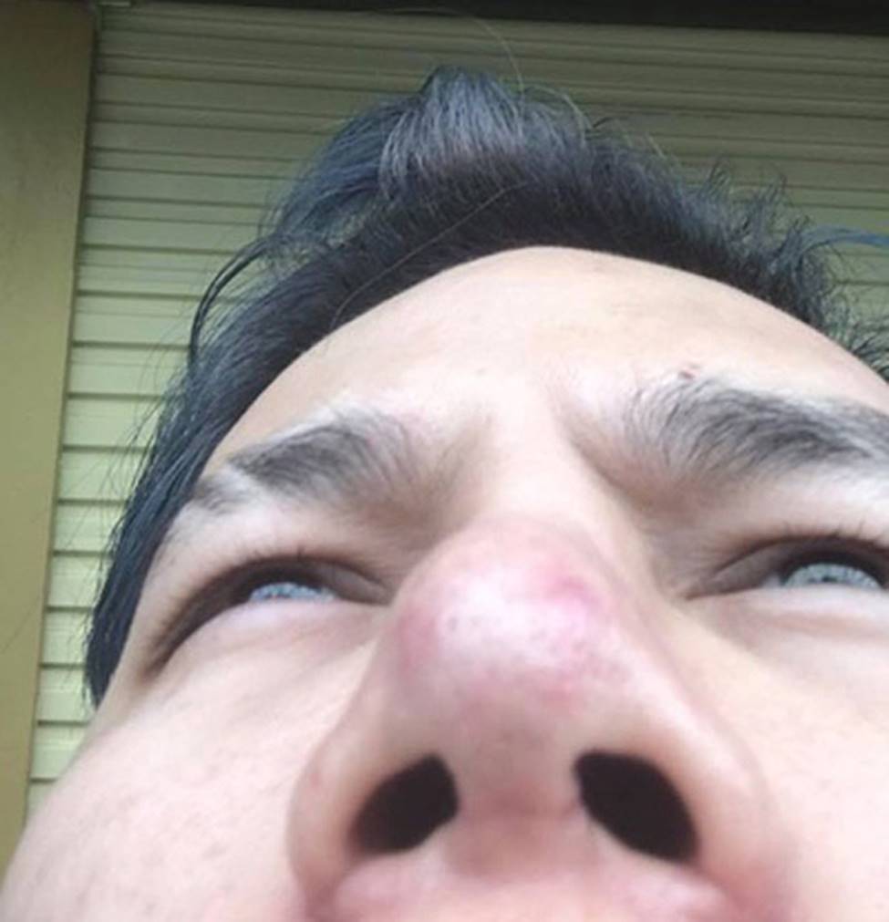 Ảnh: Trước Lệ Quyên, nhiều sao Việt gặp sự cố nhan sắc vì dao kéo-8