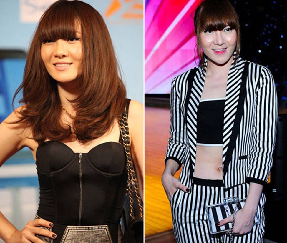 Ảnh: Trước Lệ Quyên, nhiều sao Việt gặp sự cố nhan sắc vì dao kéo-13